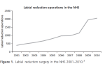 labial reductions NHS